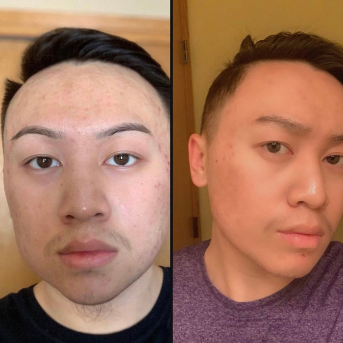 Customer 1: side hair before and after DPERM
