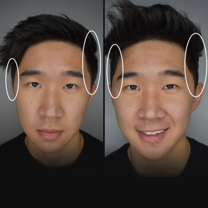 Jonathan: side hair before and after DPERM