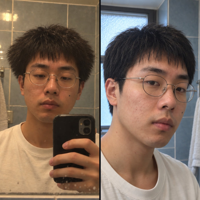 Customer 12: side hair before and after DPERM