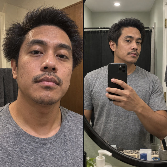 Customer 13: side hair before and after DPERM