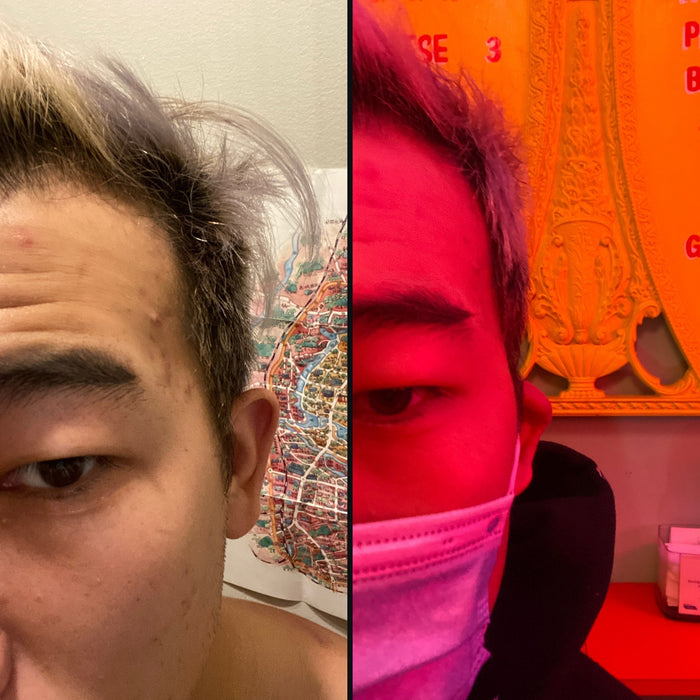 Customer 2: side hair before and after DPERM