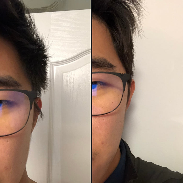 Customer 3: side hair before and after DPERM