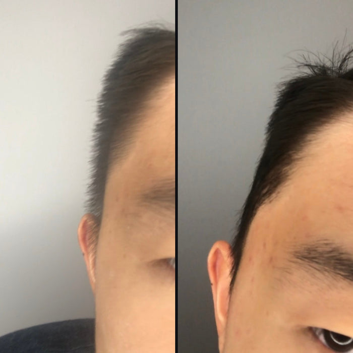 Customer 4: side hair before and after DPERM