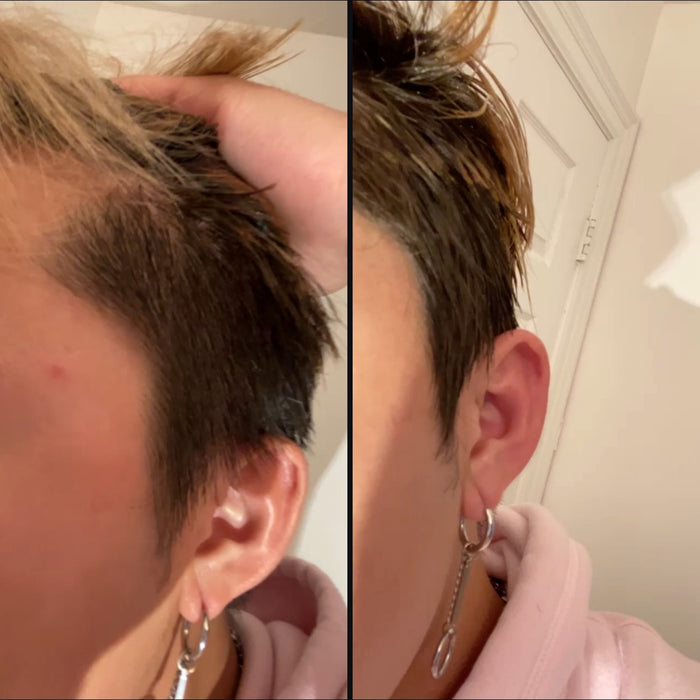 Customer 5: side hair before and after DPERM