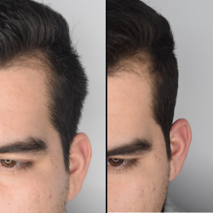 Customer 6: side hair before and after DPERM