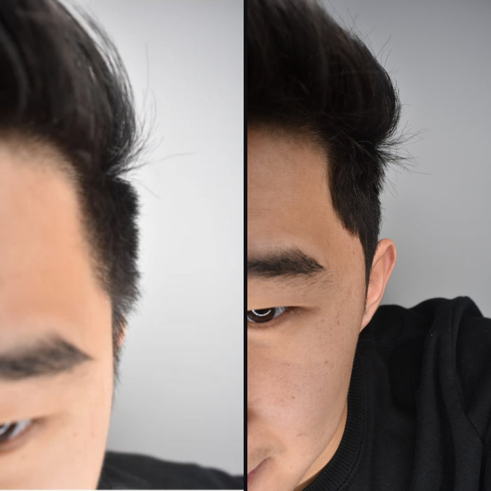 Customer 7: side hair before and after DPERM