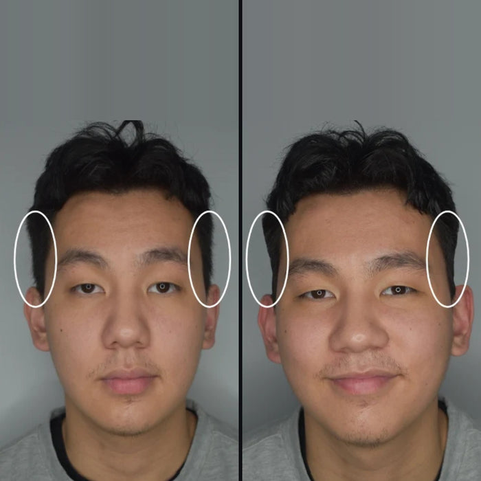 Jules: side hair before and after DPERM